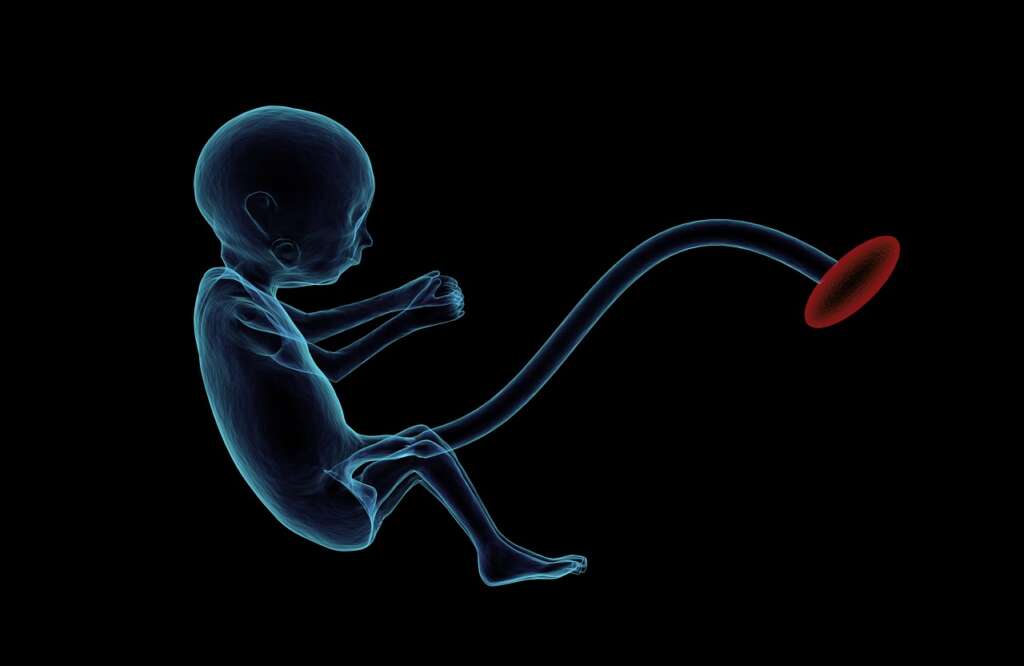 fetus, placenta, umbilical cord